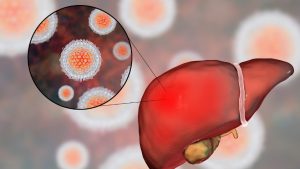 Hepatitis